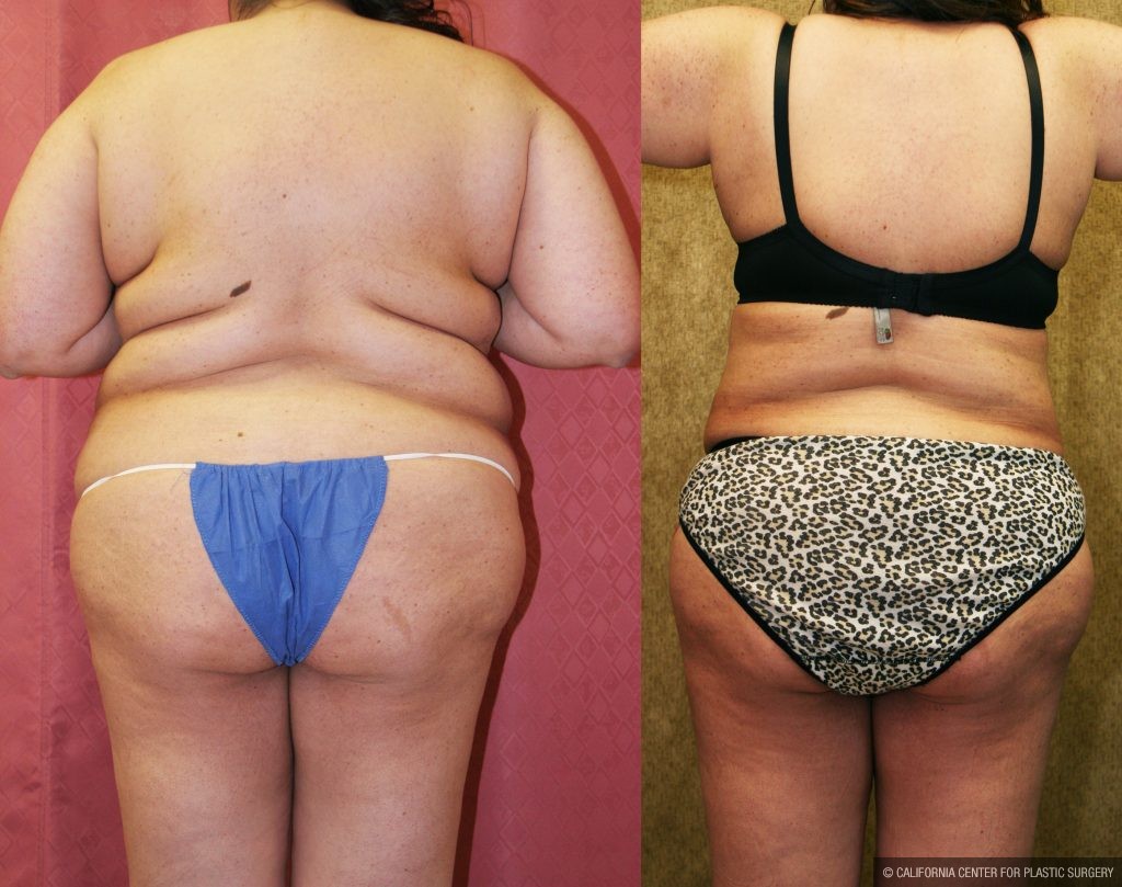 Plus Size Belly Fat Image & Photo (Free Trial)