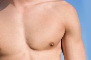 chest liposuction treatment area